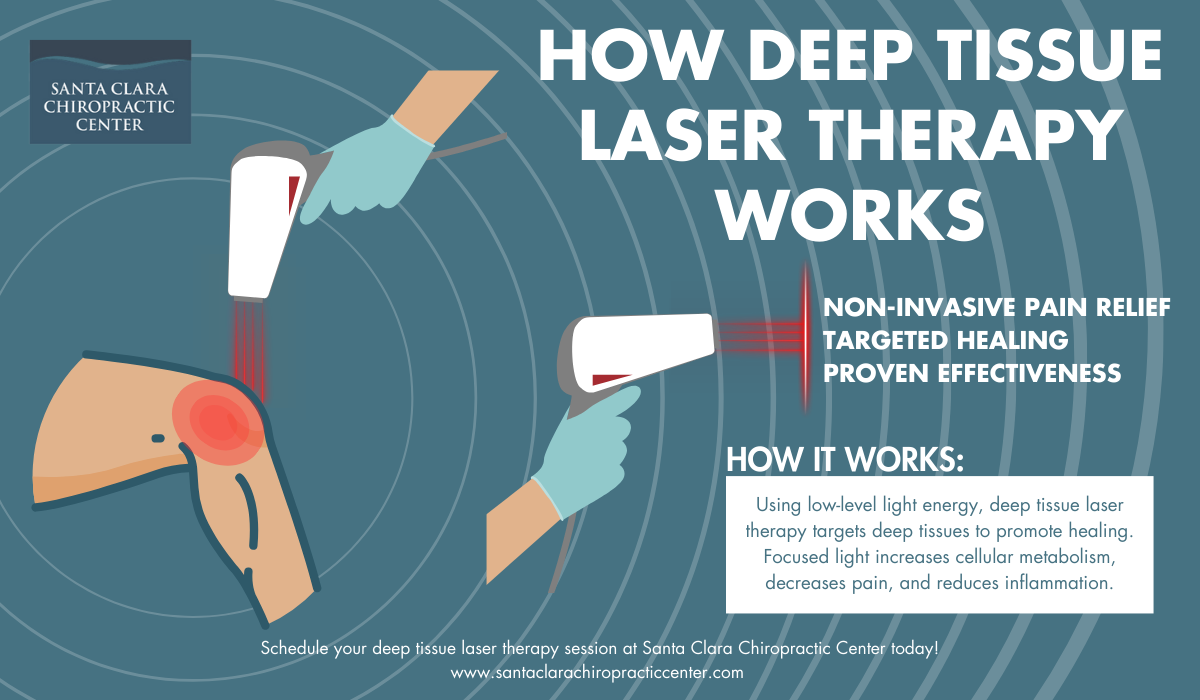 Deep Tissue Laser Therapy Santa Clara Chiropractic Center Santa